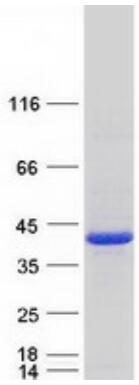 Coomassie blue staining of purified PCNA protein.